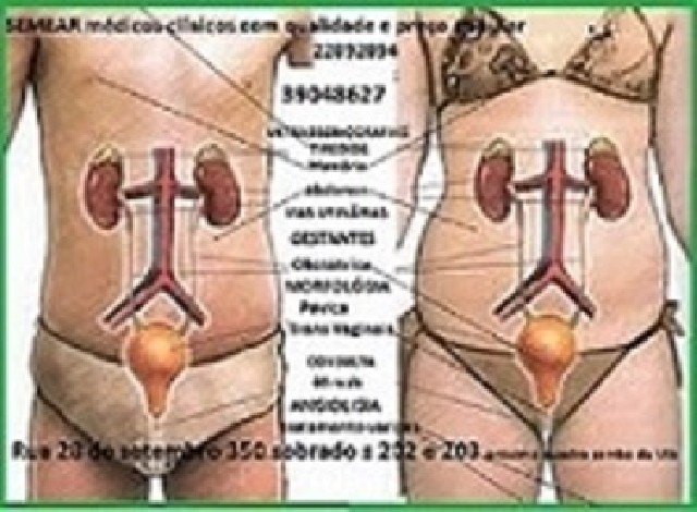 Exame de ultrassonografia masculina vila isabel
